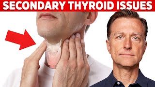 A Story of Common Thyroid Disorders [upl. by Volin]