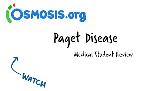 Paget Disease Osmosis Study Video [upl. by Nadabb]