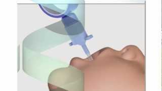 Neonatal Endotracheal Intubation [upl. by Manouch]