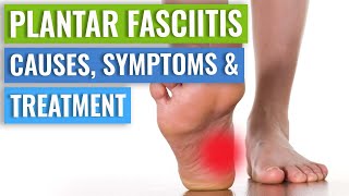 Plantar Fascitis Injection Technique [upl. by Eniamrej]