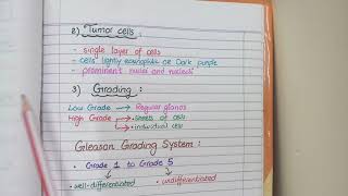 Prostate Carcinoma Pathology  Morphology and Gleason Grading [upl. by Drofwarc448]