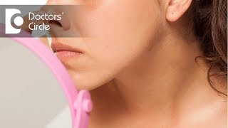 How to manage itching near nose  Dr Rasya Dixit [upl. by Ortrud]