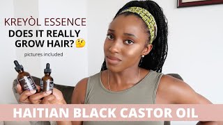 DOES IT GROW HAIR  Kreyol Essence Haitian Black Castor [upl. by Arenahs404]