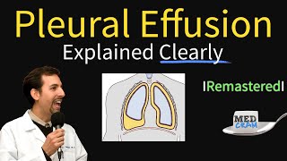 Pleural Effusions  Causes Diagnosis Symptoms Treatment [upl. by Zerdna]