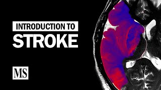 Introduction To Stroke [upl. by Ludewig]