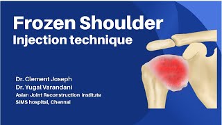 frozen shoulder injection technique [upl. by Anawk823]