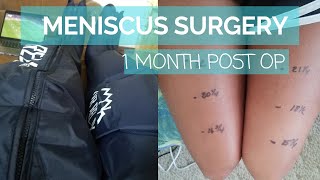 Do I Have A Meniscus Tear  Knee Tests You Can Do At Home [upl. by Ahsened]