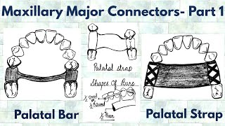 Maxillary Major Connectors  Part 1 Single Posterior Palatal Bar Palatal Strap [upl. by Esserac]