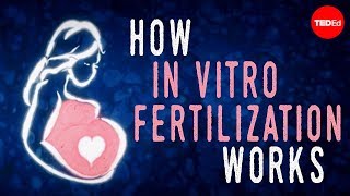 How in vitro fertilization IVF works  Nassim Assefi and Brian A Levine [upl. by Gerstner681]