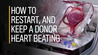 How to restart and keep a donor heart beating [upl. by Caren87]