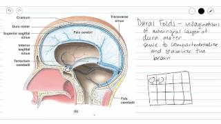 Truncus arteriosis [upl. by Eseer]