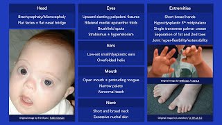 Lower Cross Syndrome  Ask Dr Abelson [upl. by Nitniuq]