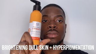 HOW I GOT RID OF DARK SPOTS BRIGHTEN DULL SKIN  HYPERPIGMENTATION [upl. by Anneres]