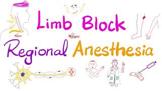 Limb Block  Peripheral Nerve Block  Regional anesthesia [upl. by Christabel723]