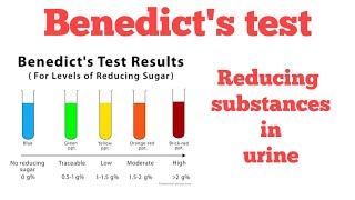 Benedicts test  Reducing substances in urine Biochemistry [upl. by Templer]