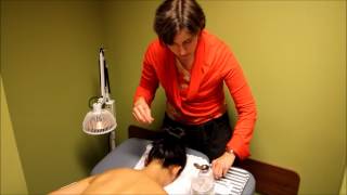 Acupuncture Demonstration and Benefits [upl. by Ayitahs133]