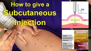 How to Give a Subcutaneous Injection Video [upl. by Iru570]