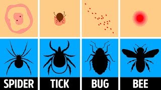 How to Identify a Bug Bite and What to Do With It [upl. by Idid]