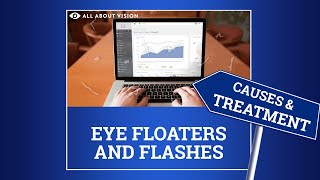 Eye Floaters Explained [upl. by Inek]