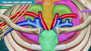 Thoracic Outlet Syndrome TOS Explained  What is TOS [upl. by Kama]