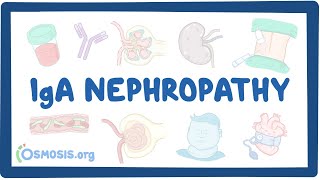 IgA nephropathy  causes symptoms diagnosis treatment pathology [upl. by Eetnahs]