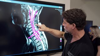 What is Cervical Stenosis  Jeffrey Cantor MD [upl. by Lancelle757]