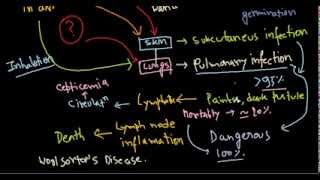 Bacillus anthracis infection [upl. by Akirahc]