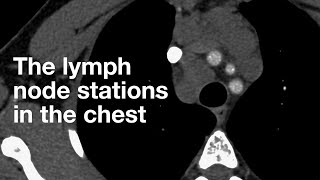 Lymphsystem Lymphatisches System lat Systema lymphaticum [upl. by Assyram]