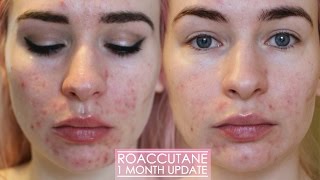 1 MONTH ROACCUTANE UPDATE  Side effects amp my skin now [upl. by Benil]