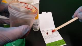 Microbiology Fecal Occult Blood [upl. by Kramnhoj57]