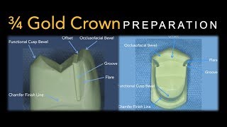 34 Gold Crown Preparation  Maxillary Premolar [upl. by Maidie]