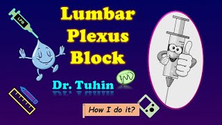 PNS guided Lumbar Plexus Block  LPB I Anatomy  Landmark  Peripheral Nerve Stimulation [upl. by Onej]