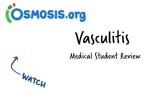 Vasculitis  Clinical Presentation [upl. by Burger]