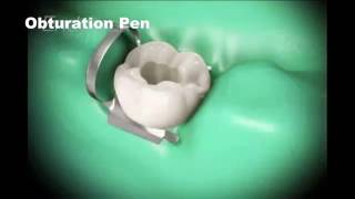 Root canal treatment and Cap [upl. by Ltney]