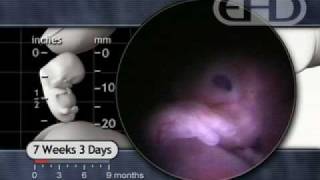 7 Weeks Pregnant  Hiccups amp Startle Response [upl. by Ennadroj]