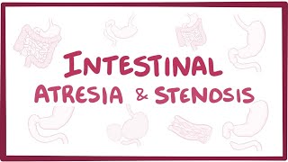 Intestinal atresia amp stenosis  an Osmosis Preview [upl. by Yroffej]