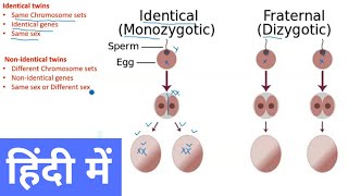 Types of Twins in Hindi [upl. by Normalie]