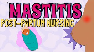 MASTITIS Maternal Newborn Nursing [upl. by Lleira457]