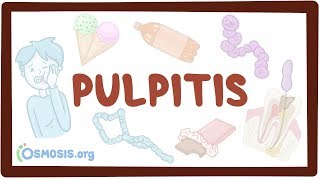 Pulpitis  causes symptoms diagnosis treatment pathology [upl. by Lennaj]