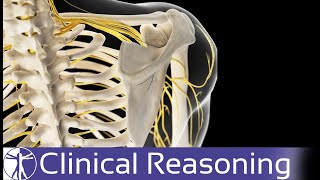 Thoracic outlet syndrome  Part1  Animation  Introduction  Anatomy  Types  Causes and imaging [upl. by Whitson]