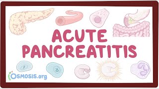 Acute pancreatitis  an Osmosis Preview [upl. by Cissiee]