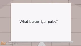 What is a Corrigan pulse [upl. by Darell]