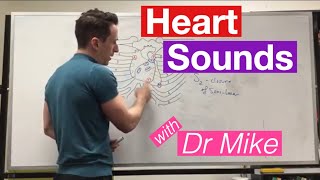 S1 Heart Sound  Learn How to Auscultate Part 8 [upl. by Tobit]