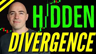 Best Divergence Trading Strategy [upl. by Anairb]