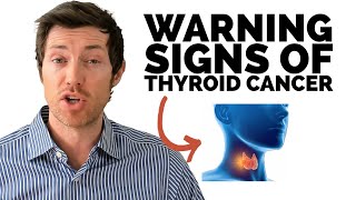 Thyroid Cancer Symptoms amp Early Warning Signs [upl. by Ecertap694]