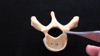 Typical Vertebra  Spinal column  Anatomy [upl. by Demah]