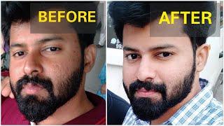 Get brighter skin Naturally in 2 Weeks  No side effects  Tamil  shadhikazeez [upl. by Vaasta599]