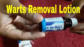 Wart Removal Lotion [upl. by Llehsad]