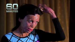 TURIA PITT  60 MINUTES [upl. by Yenahpets]