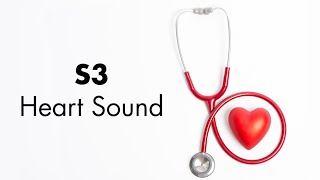 S3 Heart Sound  MEDZCOOL [upl. by Ned]